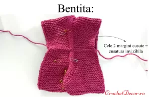 3_Cusatura invizibila a bentitei_Caciula 1898